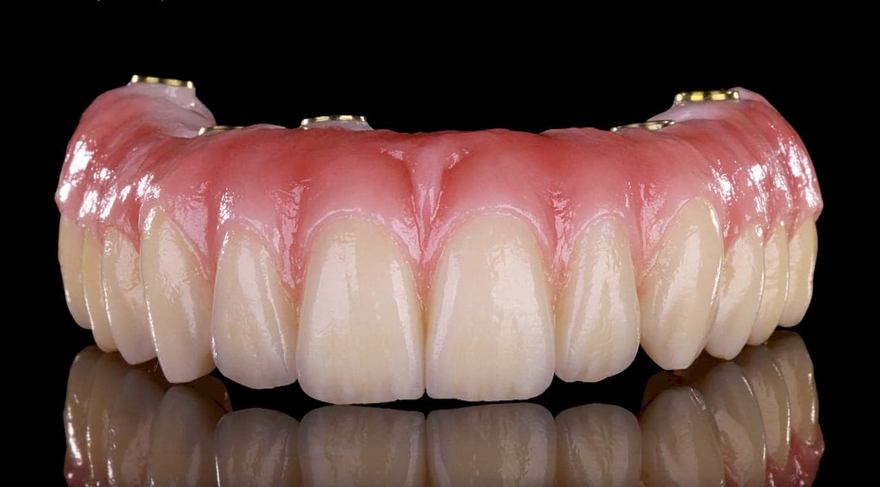 Best All-on-4 Dental Implants in Jacksonville, FL (2026)