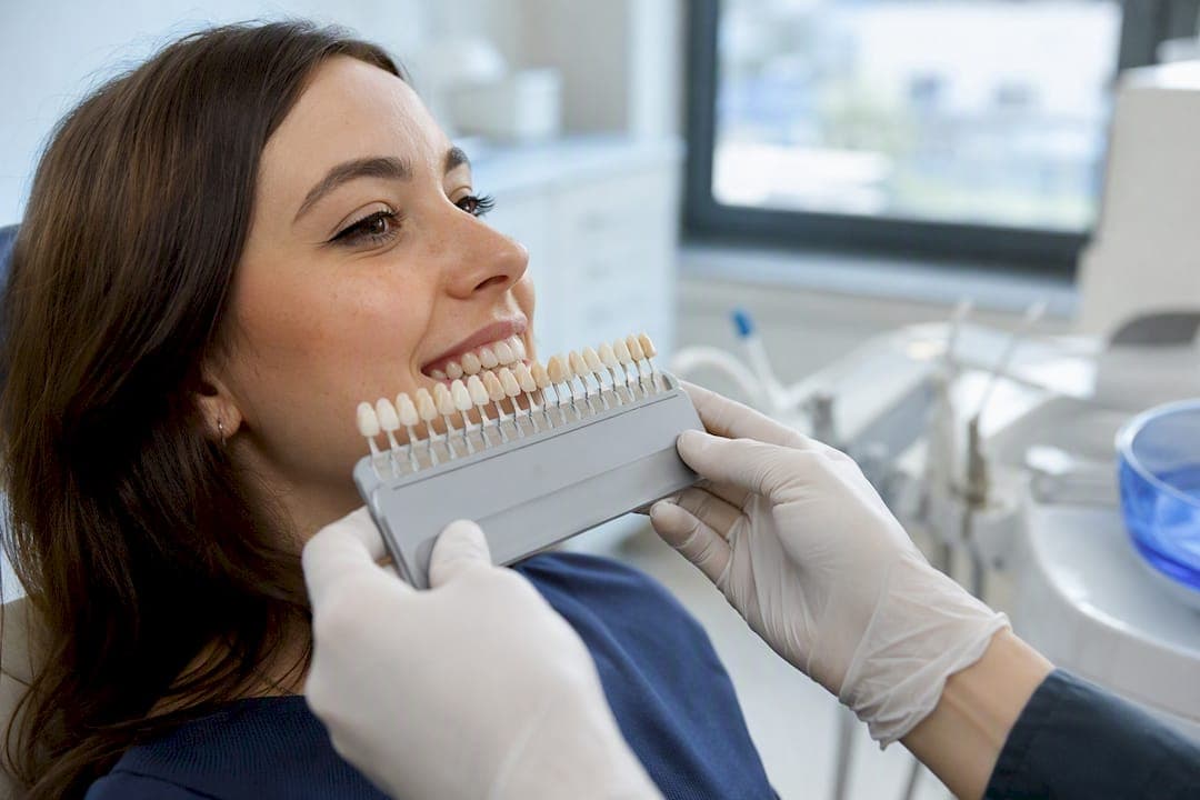 Tooth Shade Selection for Implants: How Dentists Match Color